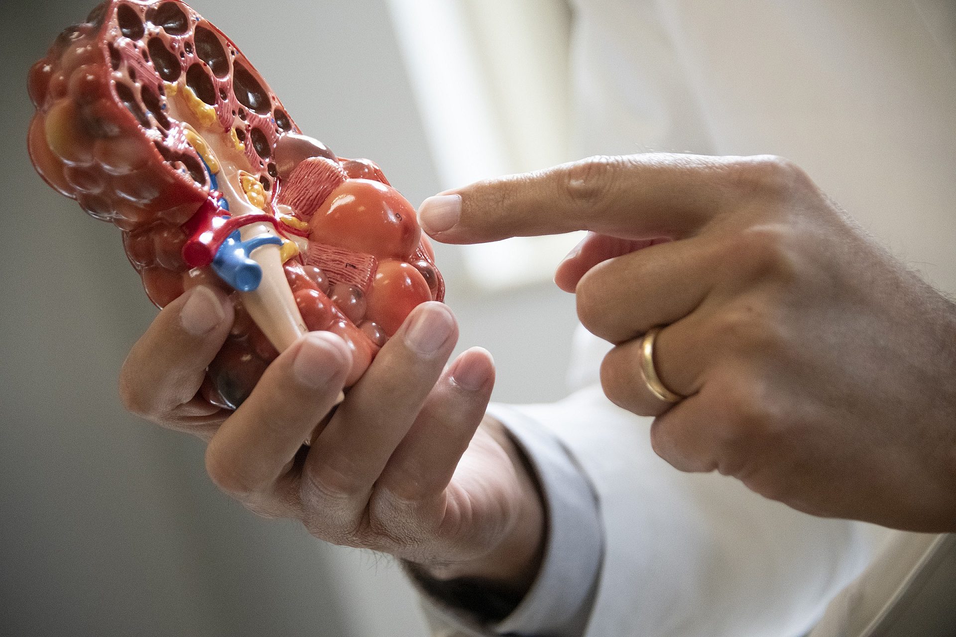 Hands holding and pointing to a detailed anatomical model of a human kidney.