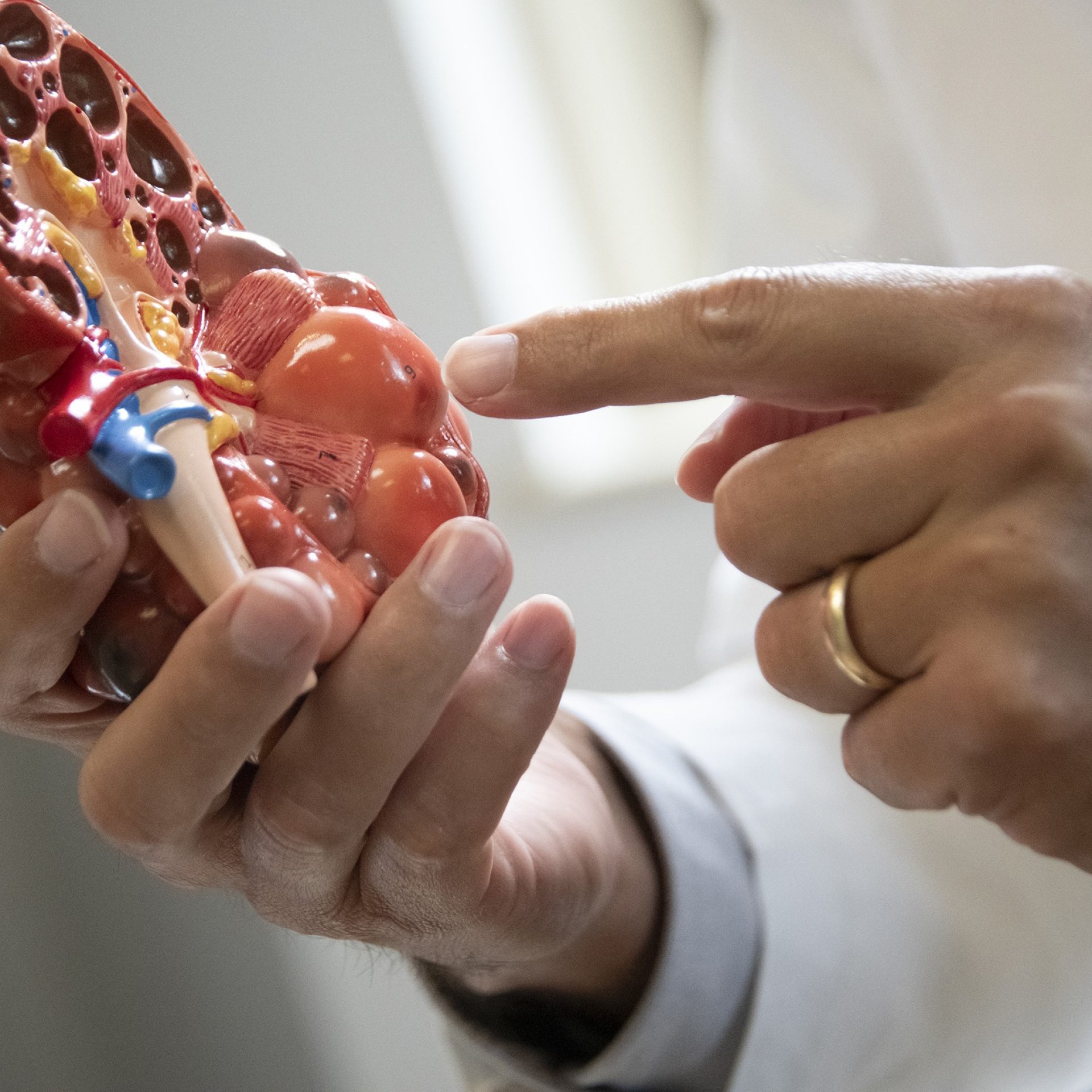 Hands holding and pointing to a detailed anatomical model of a human kidney.